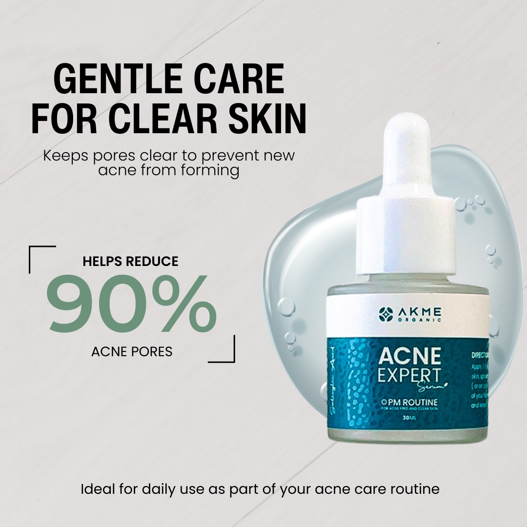 Natural Glow Serum for Oily & Acne-Prone Skin Care